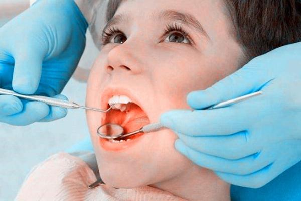 兒童換牙是全部都換嗎 兒童換牙幾歲開始換